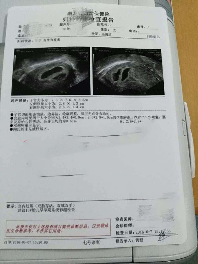 ���ݴ���